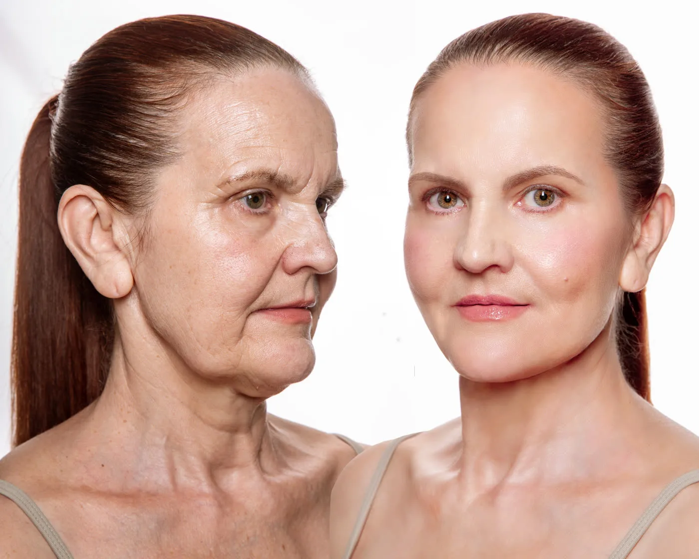 Skin rejuvenation