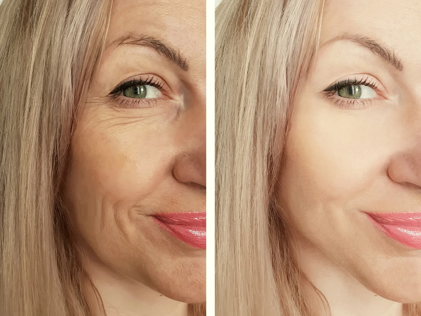 Skin firmness