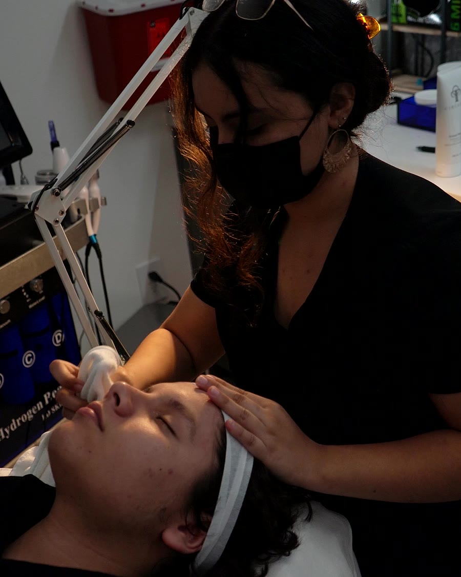 Laser Skin Resurfacing