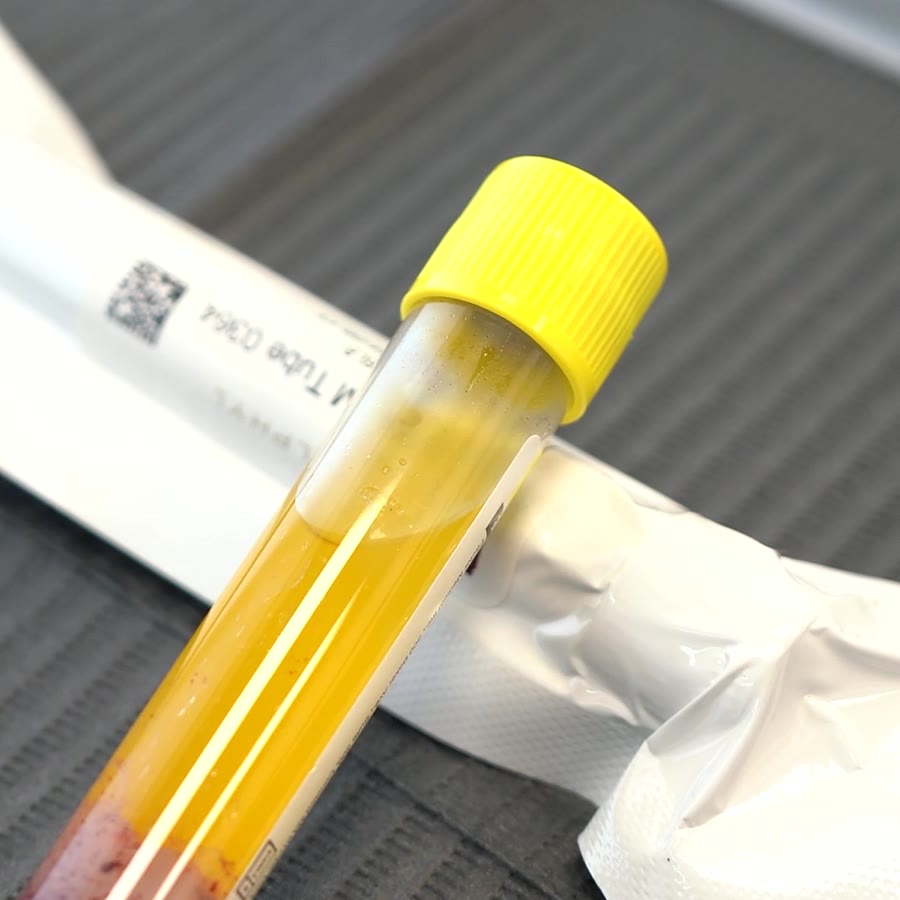 PRP / PRF Facial