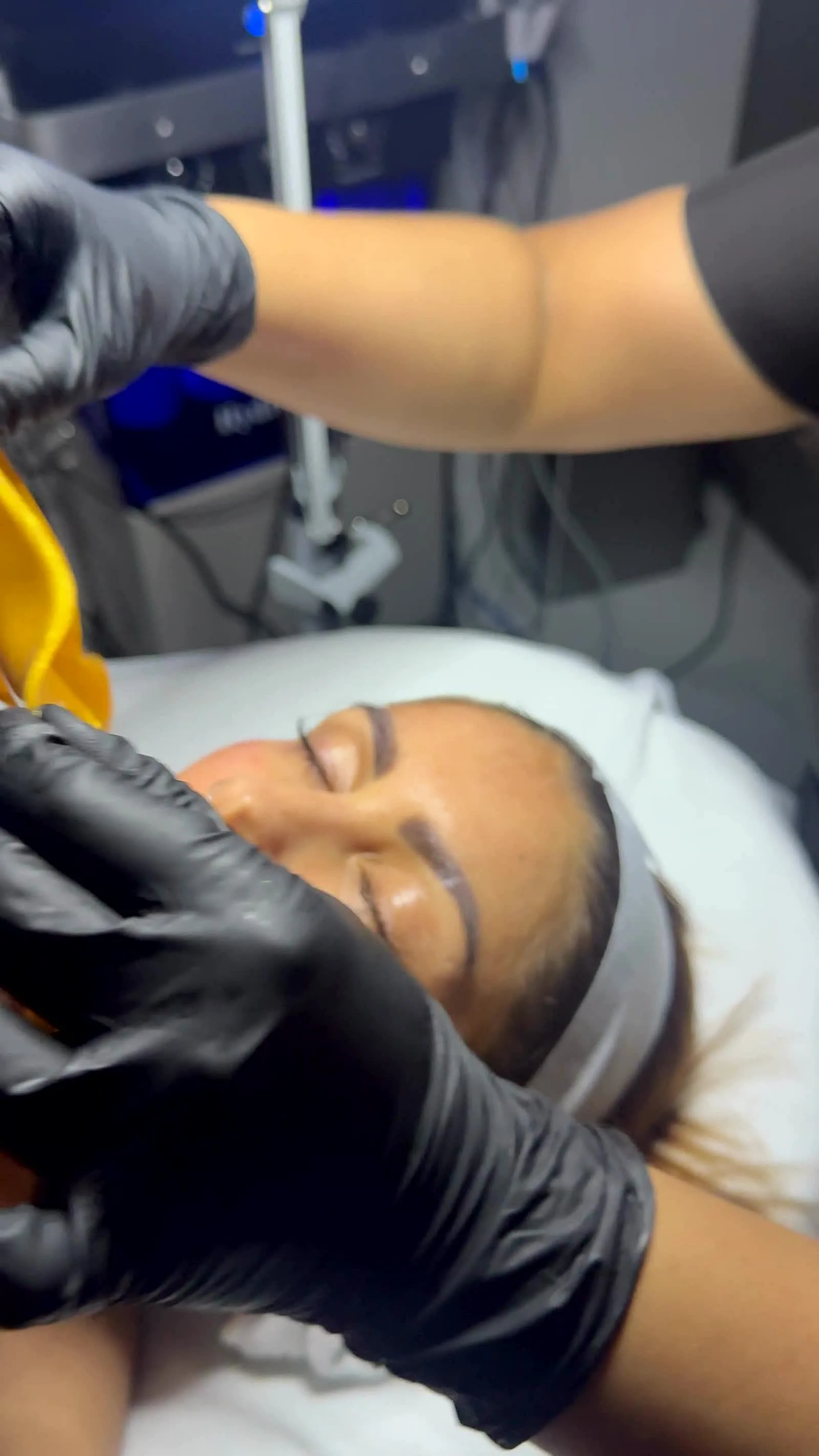 Skin rejuvenation