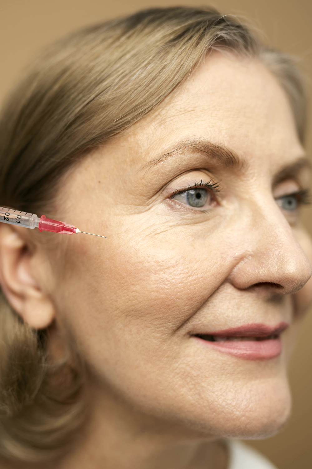 Cheek Filler