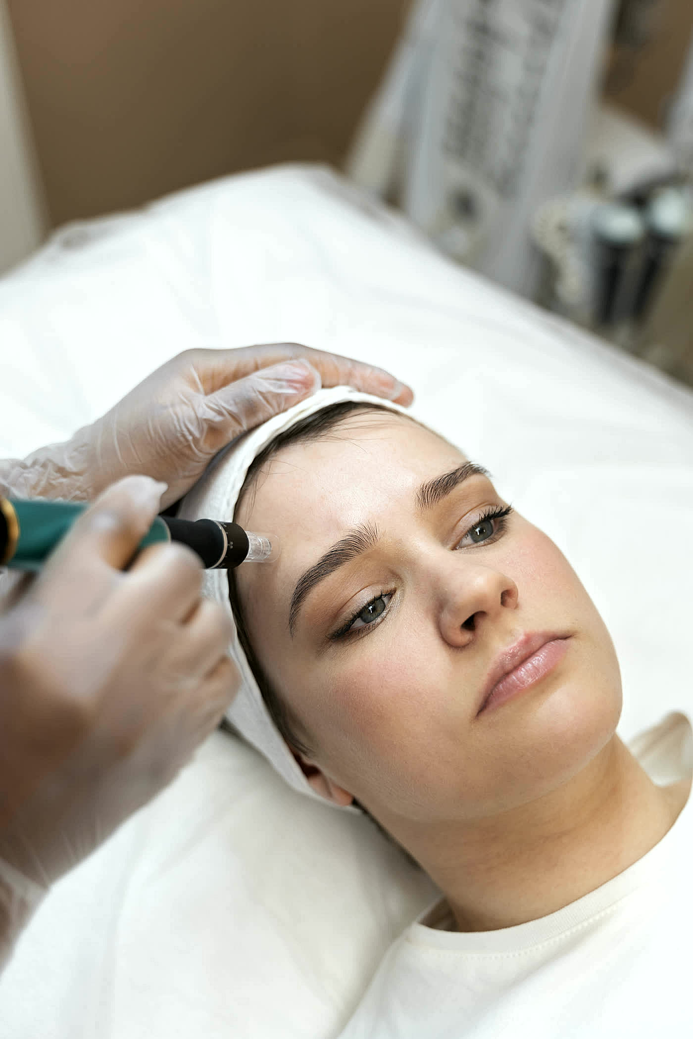 Microneedling + PRP