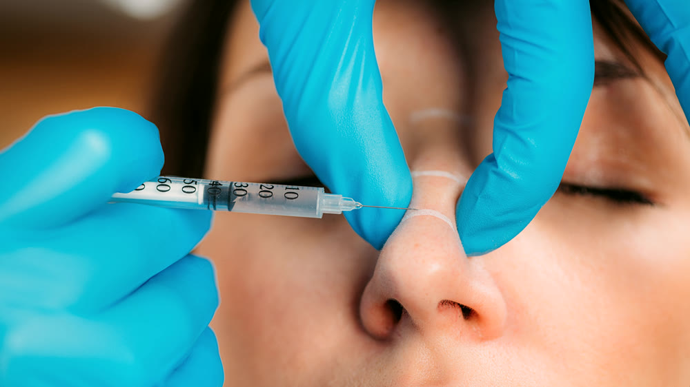 Nonsurgical Rhinoplasty