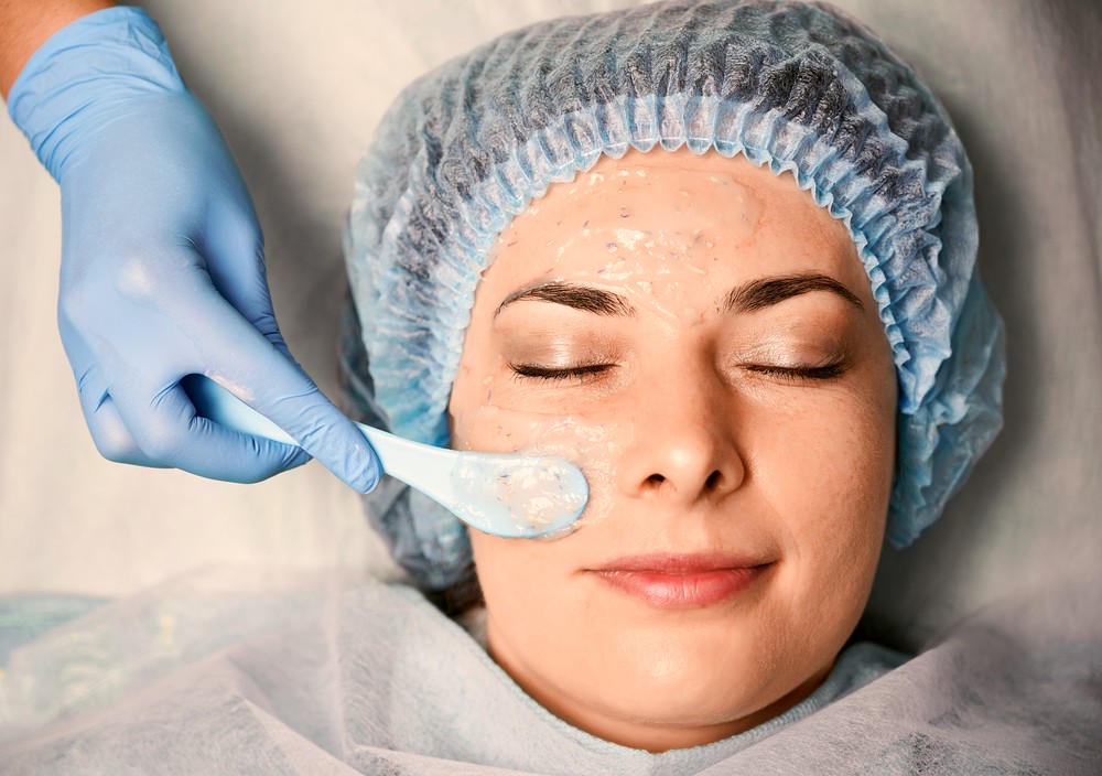 Perfect Derma Peel
