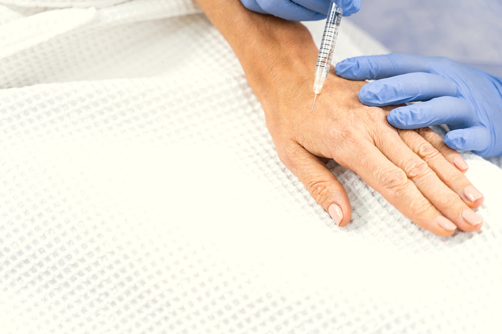 Radiesse+ Rejuvenecimiento Facial y de Manos